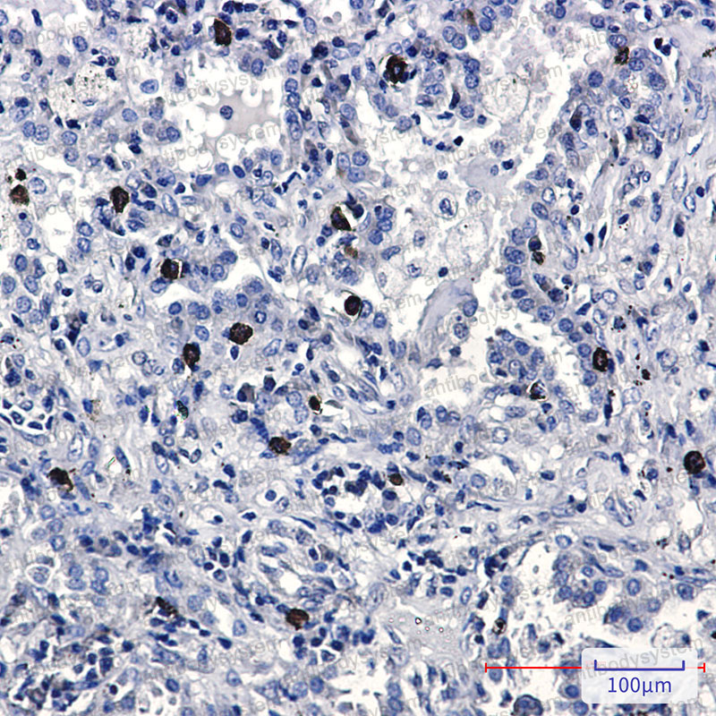 Anti-FLI1 Antibody (R2B95)