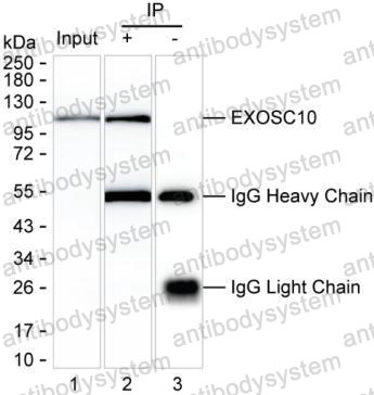 Immunoprecipitation for Anti-EXOSC10 Antibody (R3Q41) ?>