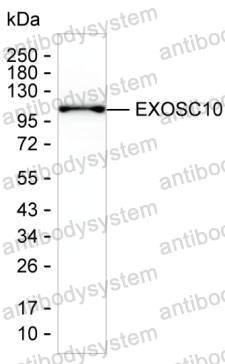 Western blot for Anti-EXOSC10 Antibody (R3Q41) ?>