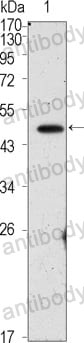 Anti-POU5F1/OCT3/OCT4 Antibody (R3Q45)
