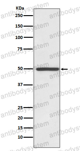 Anti-SLC6A3 Antibody (R2C05)