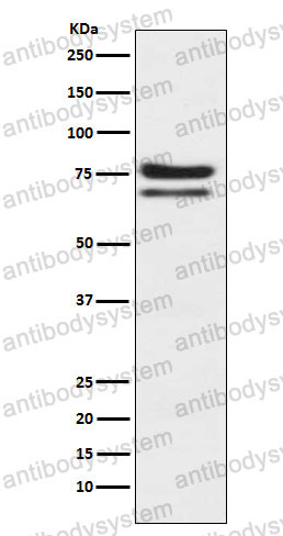 Anti-PRKCE Antibody (R2C12)