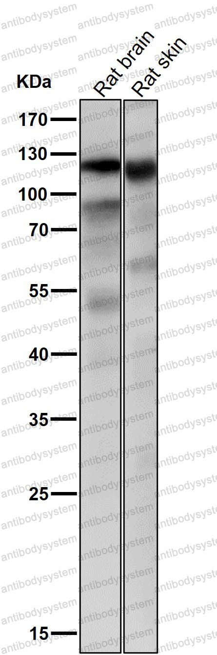 Anti-KIF23 Antibody (R1A10)