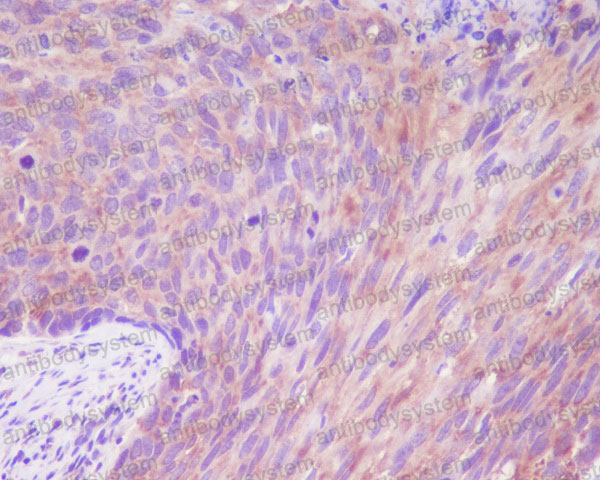 Anti-DSG1/Desmoglein-1 Antibody (R1A07)