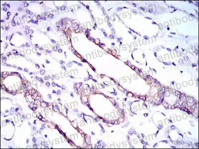 Immunohistochemical for Anti-RPL18A Antibody (R3Q62) ?>