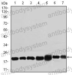 Western blot for Anti-RPL18A Antibody (R3Q62) ?>