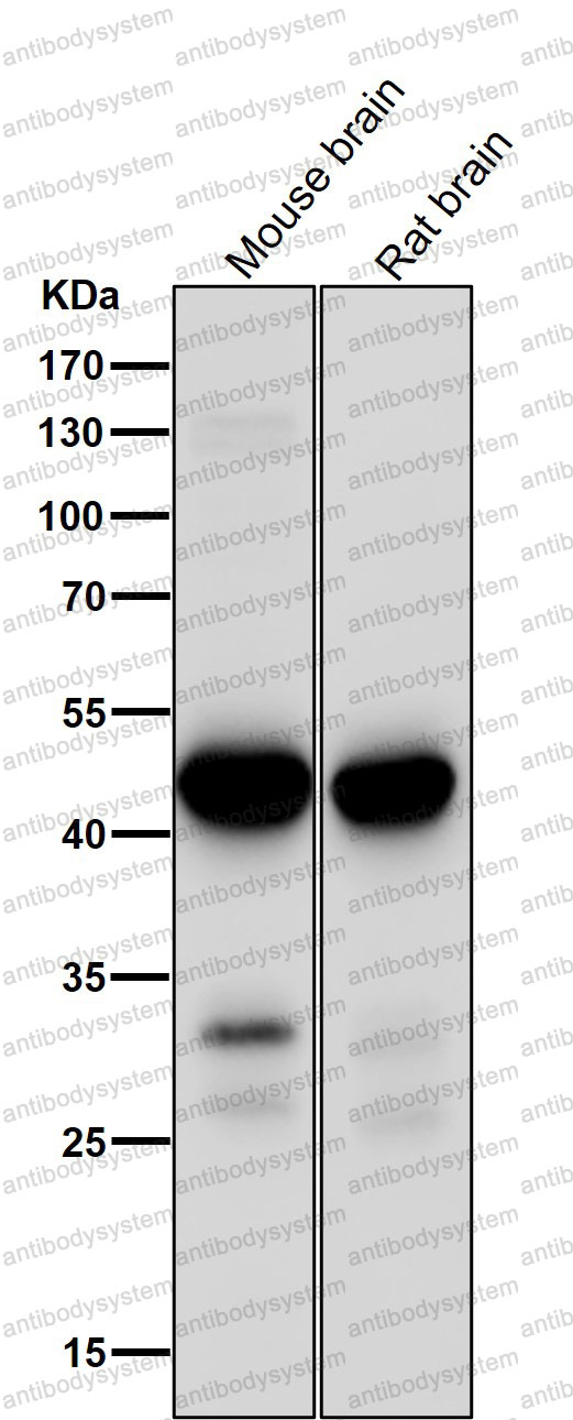 Anti-MAP2K1/MEK1 Antibody (R1B91)