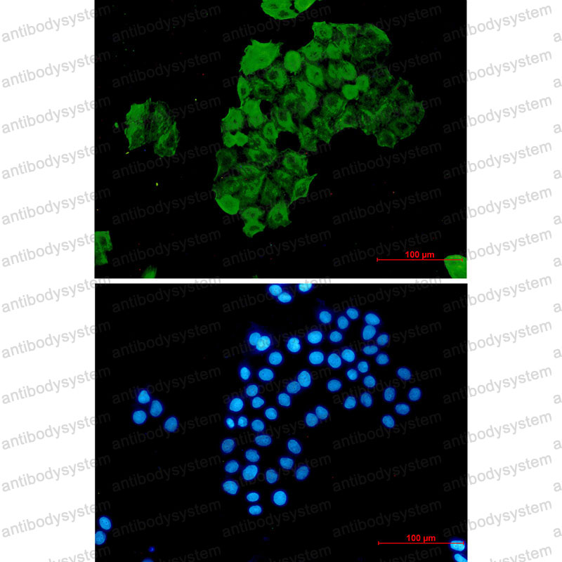 Anti-FKBP4 Antibody (R2C27)