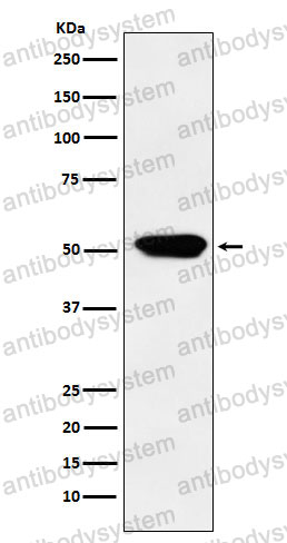 Anti-CYP4A11 Antibody (R2C28)