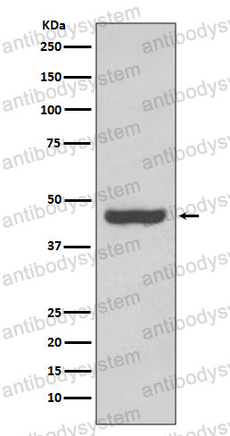 Anti-PAX2 Antibody (R2C29)