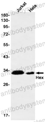 Anti-HHEX Antibody (R2C31)