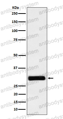 Anti-HHEX Antibody (R2C30)