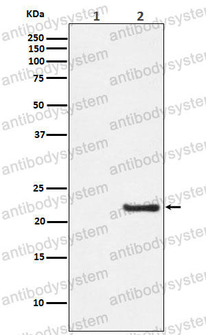 Anti-Phospho-CAV1/Caveolin-1 (Y14) Antibody (R2C32)