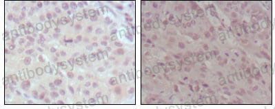 Immunohistochemical for Anti-KMT2A/MLL Antibody (R3Q75) ?>