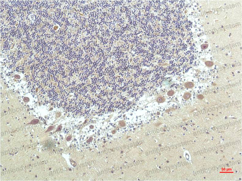 Immunohistochemical for Anti-PPARD Antibody (R3Q79) ?>