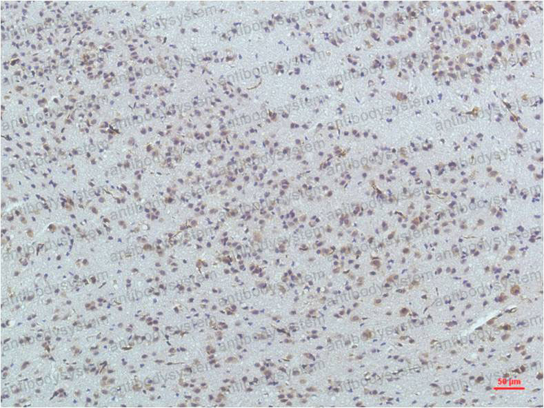 Immunohistochemical for Anti-PPARD Antibody (R3Q79) ?>