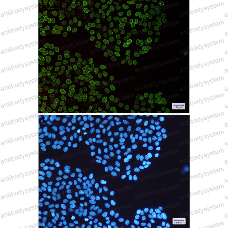 Anti-LMNB2 Antibody (R2C35)