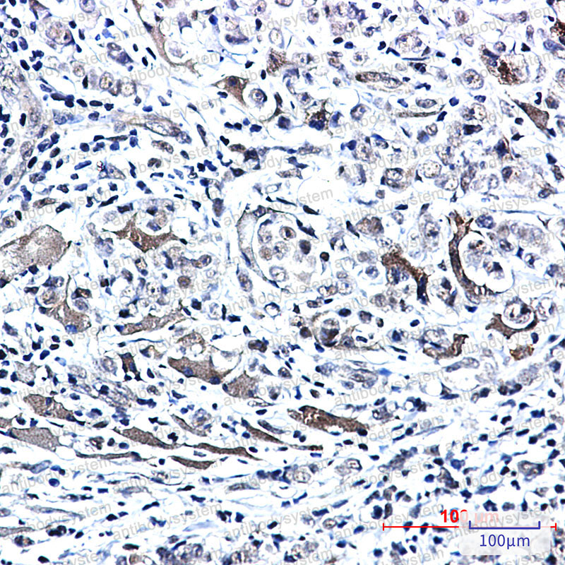 Anti-Phospho-PTS (Ser19) Antibody (R2C37)