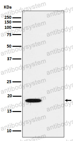 Anti-Phospho-PTS (S19) Antibody (R2C36)