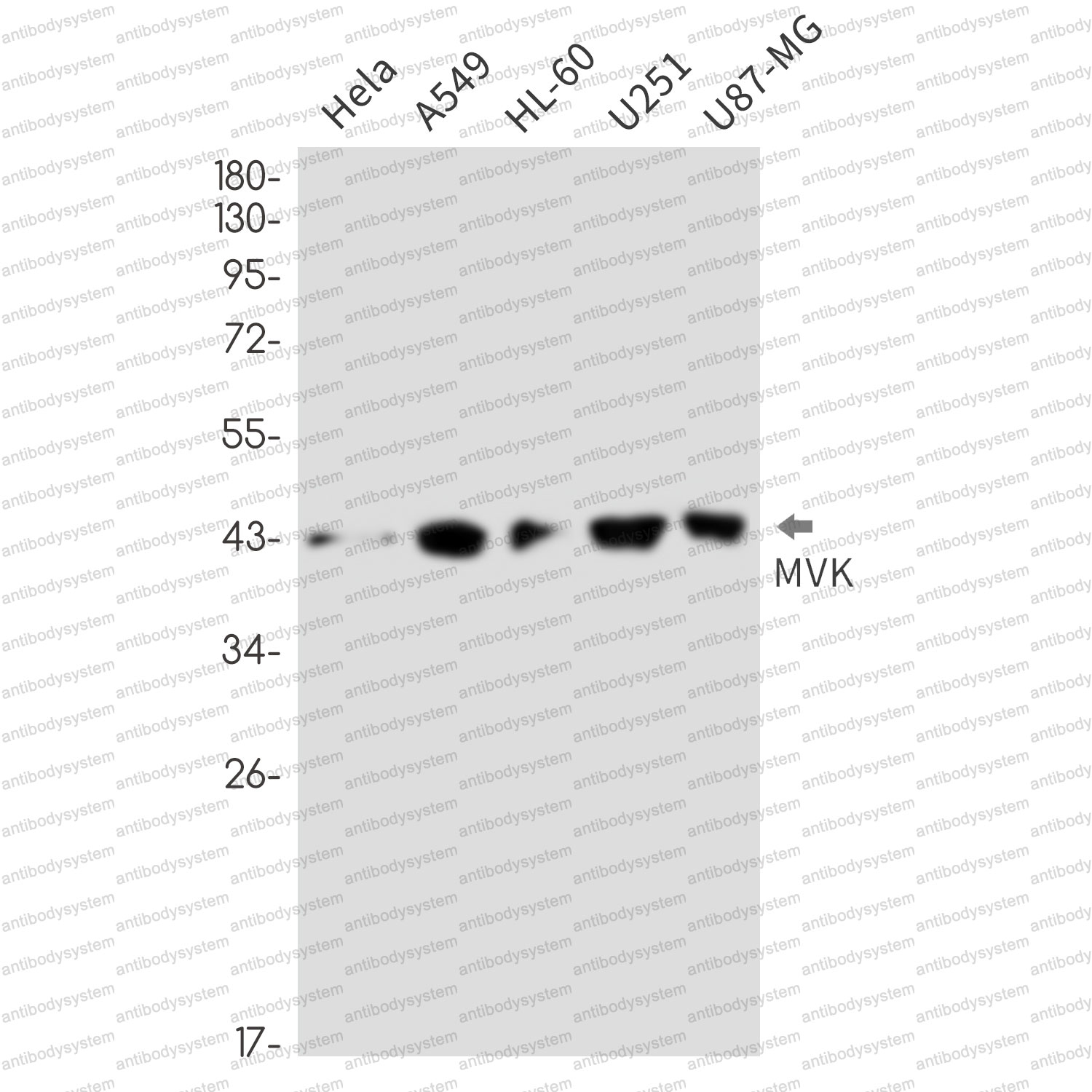 Anti-MVK Antibody (R2C39)