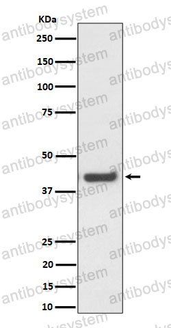 Anti-MVK Antibody (R2C38)