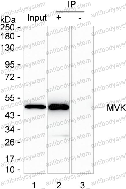 Immunoprecipitation for Anti-MVK Antibody (R3Q84) ?>