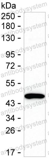 Western blot for Anti-MVK Antibody (R3Q84) ?>