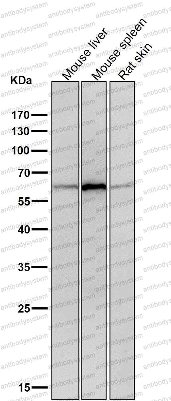 Anti-COL10A1 Antibody (R2C40)