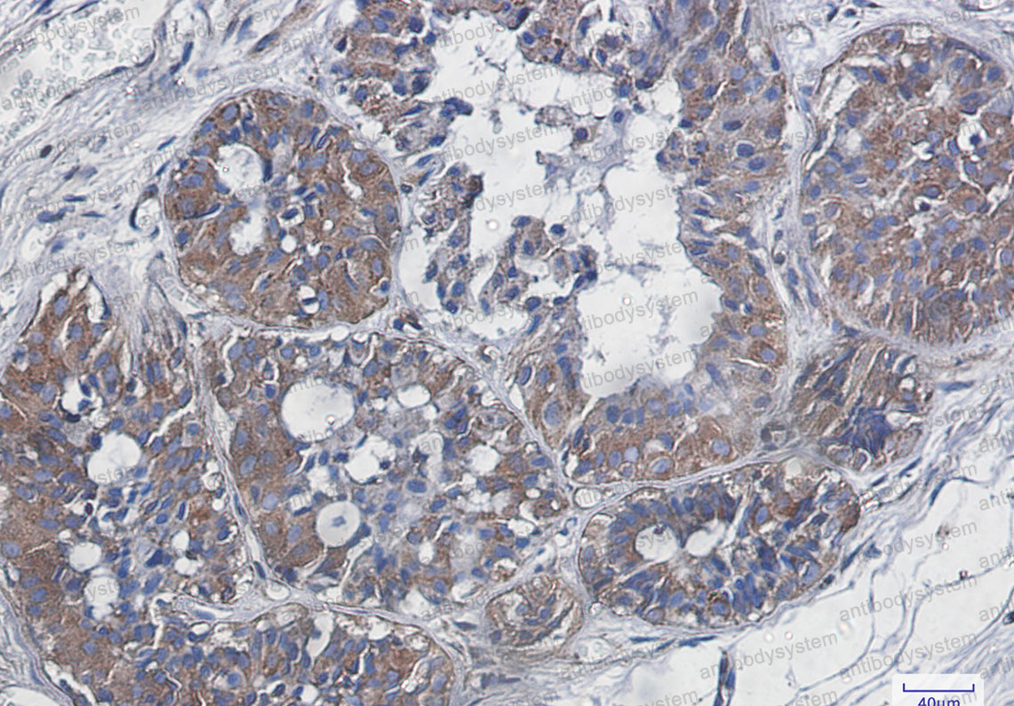 Anti-RELA Antibody (R2C43)