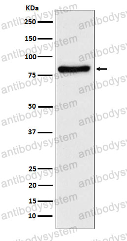Anti-TLE1 Antibody (R2C46)