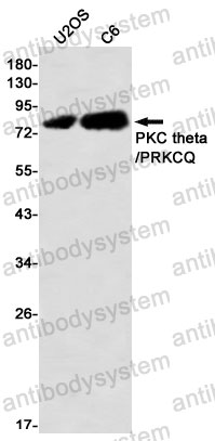 Anti-PRKCQ Antibody (R2C48)