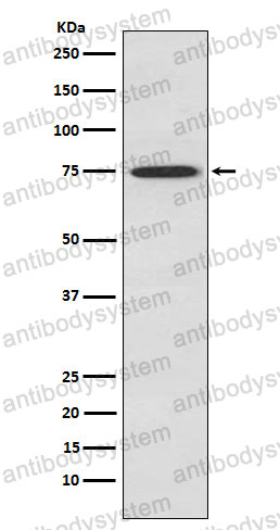 Anti-PRKCQ Antibody (R2C47)