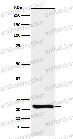 Anti-GLO1 Antibody (R2C49)