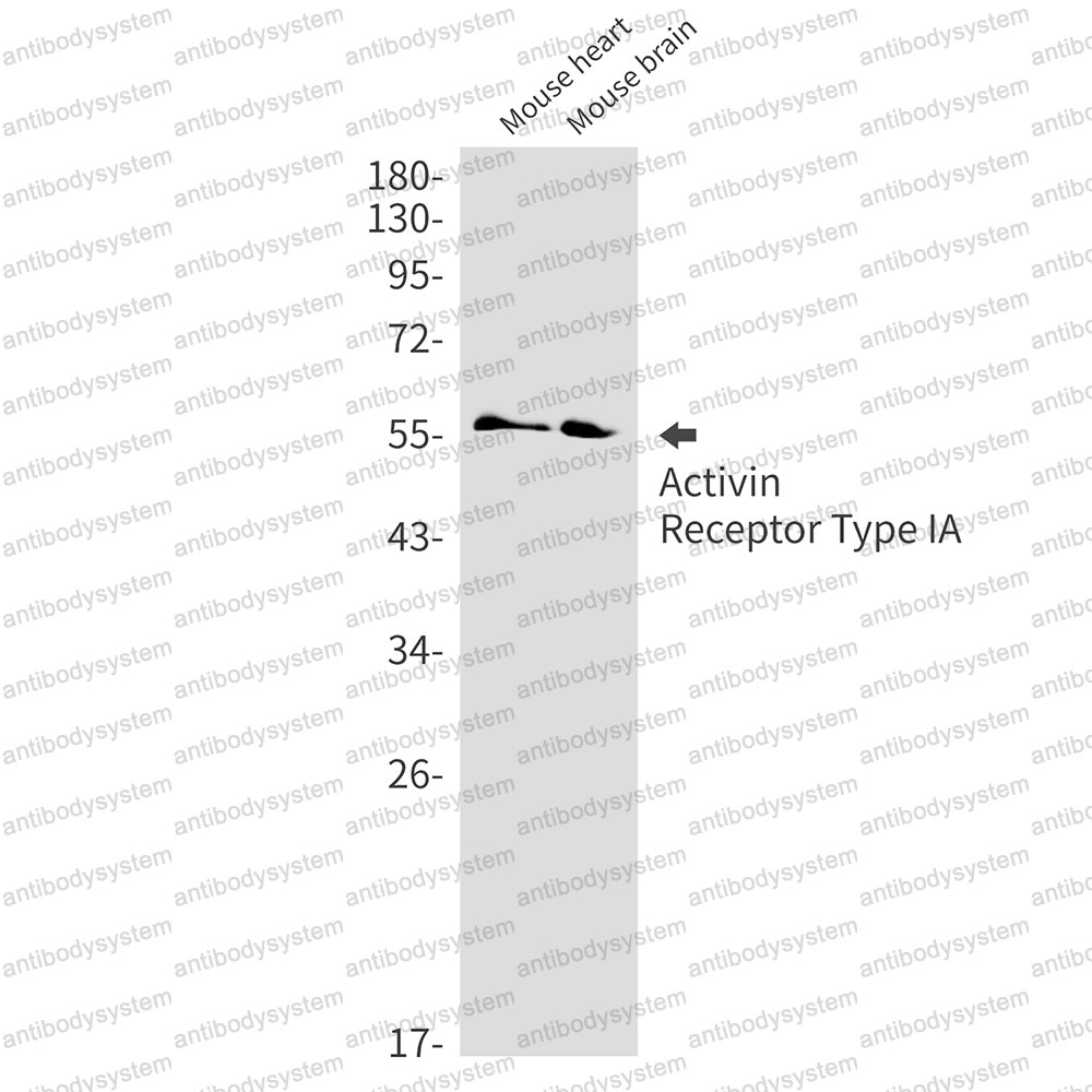 Anti-ACVR1/ALK-2 Antibody (R2C50)