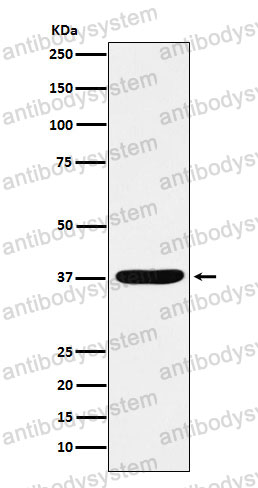 Anti-AKR1C1/AKR1C2 Antibody (R2C51)