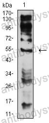 Western blot for Anti-CHRNE Antibody (R3R05) ?>