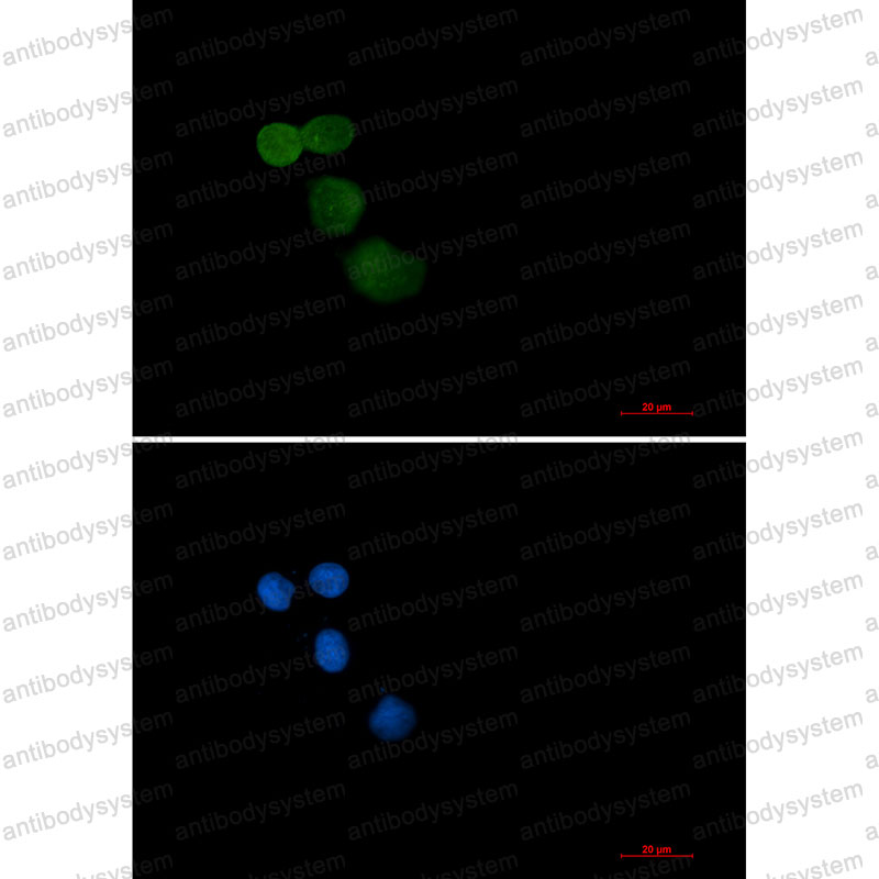 Anti-UBE3A Antibody (R2C54)