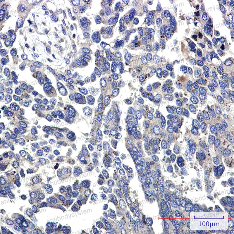 Anti-PTK2 Antibody (R2C58)