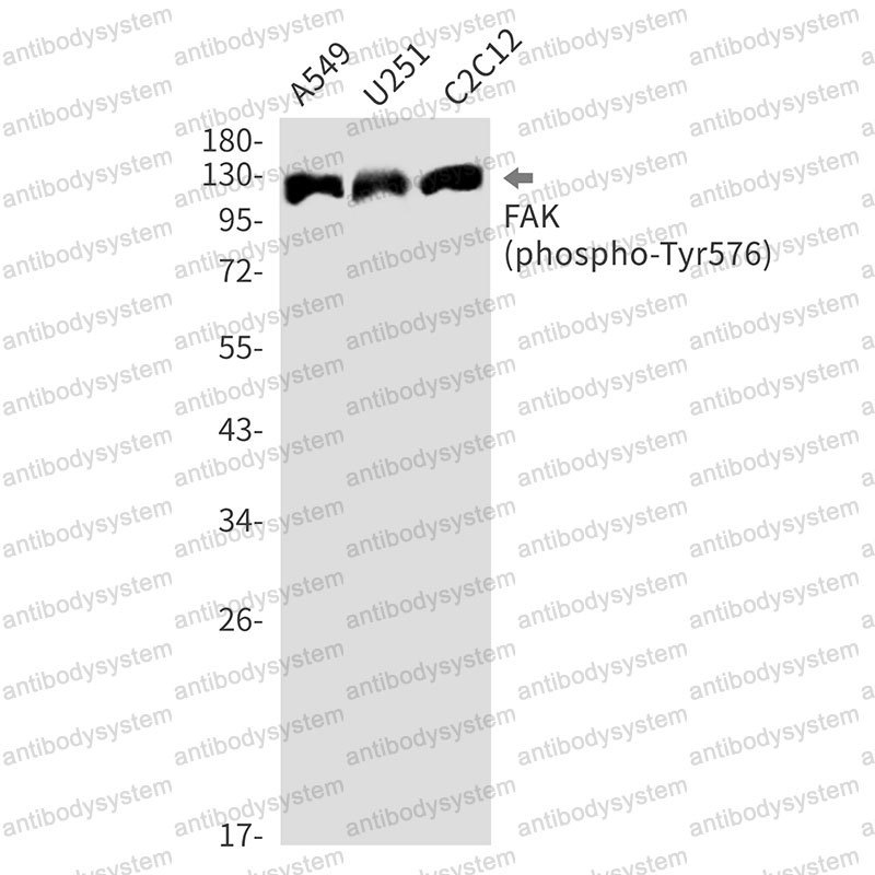 Anti-Phospho-PTK2/FAK (Tyr576) Antibody (R2C56)