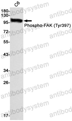 Anti-Phospho-PTK2/FAK (Tyr397) Antibody (R2C55)