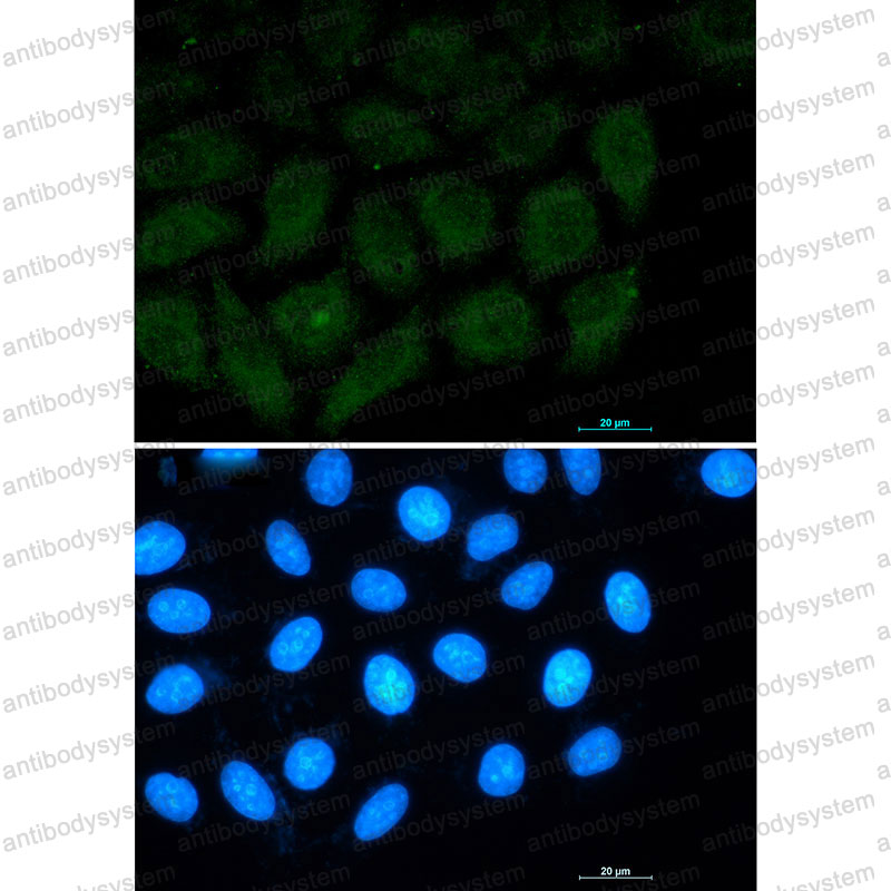 Anti-PTK2 Antibody (R2C57)