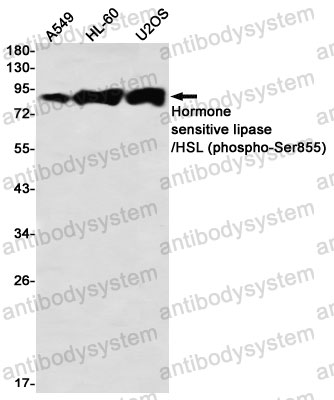 Anti-Phospho-LIPE (Ser855) Antibody (R2C60)