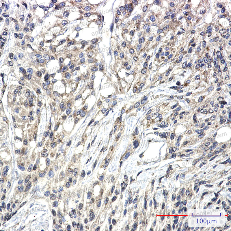 Anti-Phospho-PKC zeta/lambda (Thr410/Thr412) Antibody (R2C63)