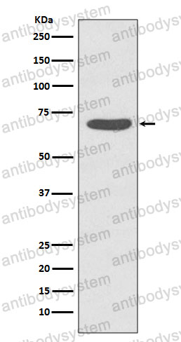 Anti-Phospho-PRKCZ (T560) Antibody (R2C61)