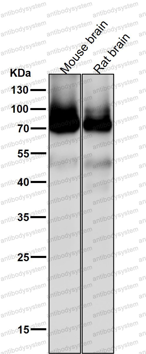 Anti-PRKCZ Antibody (R2C62)