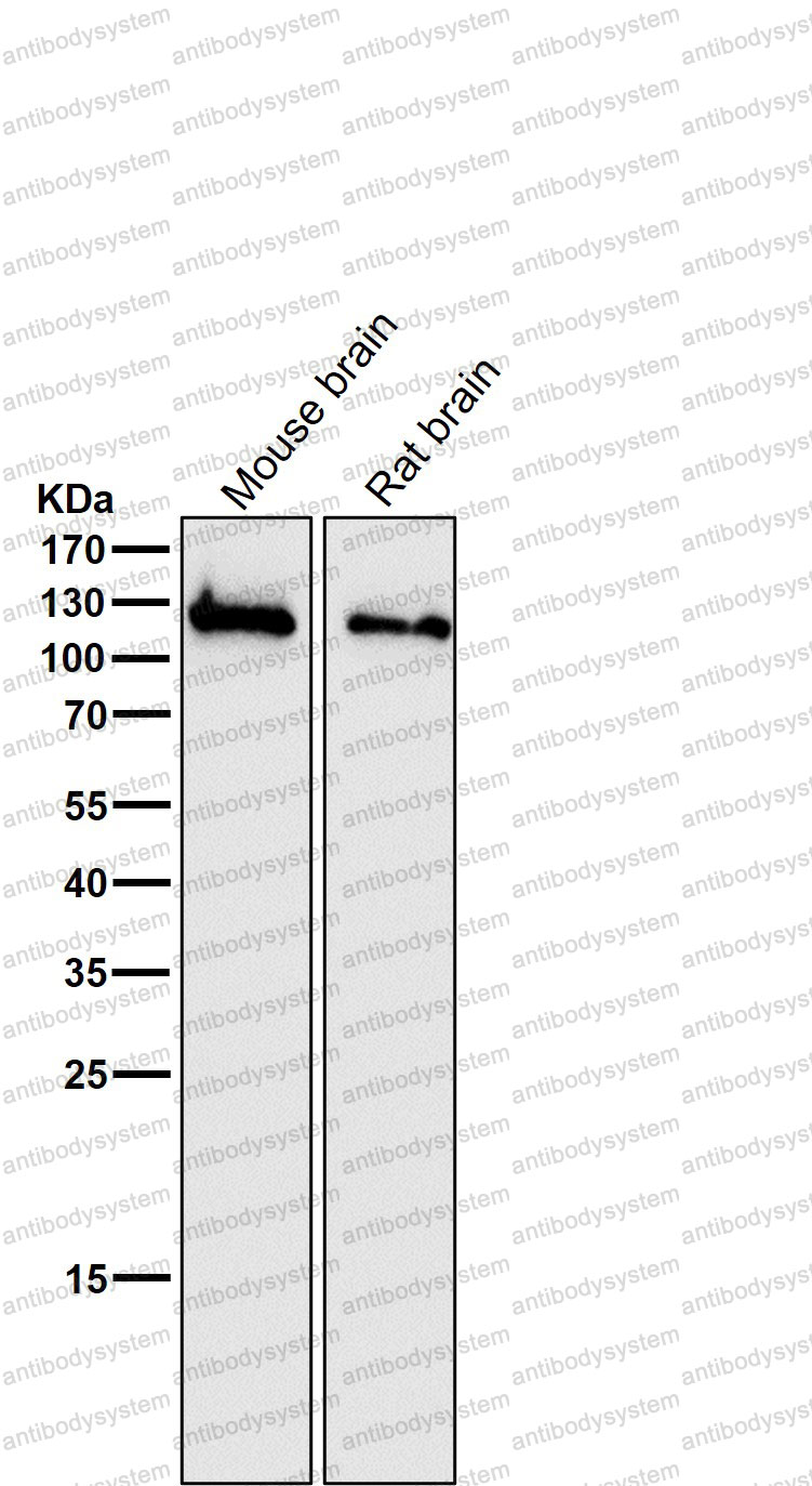 Anti-GRIN1/NMDAR1 Antibody (R2C64)