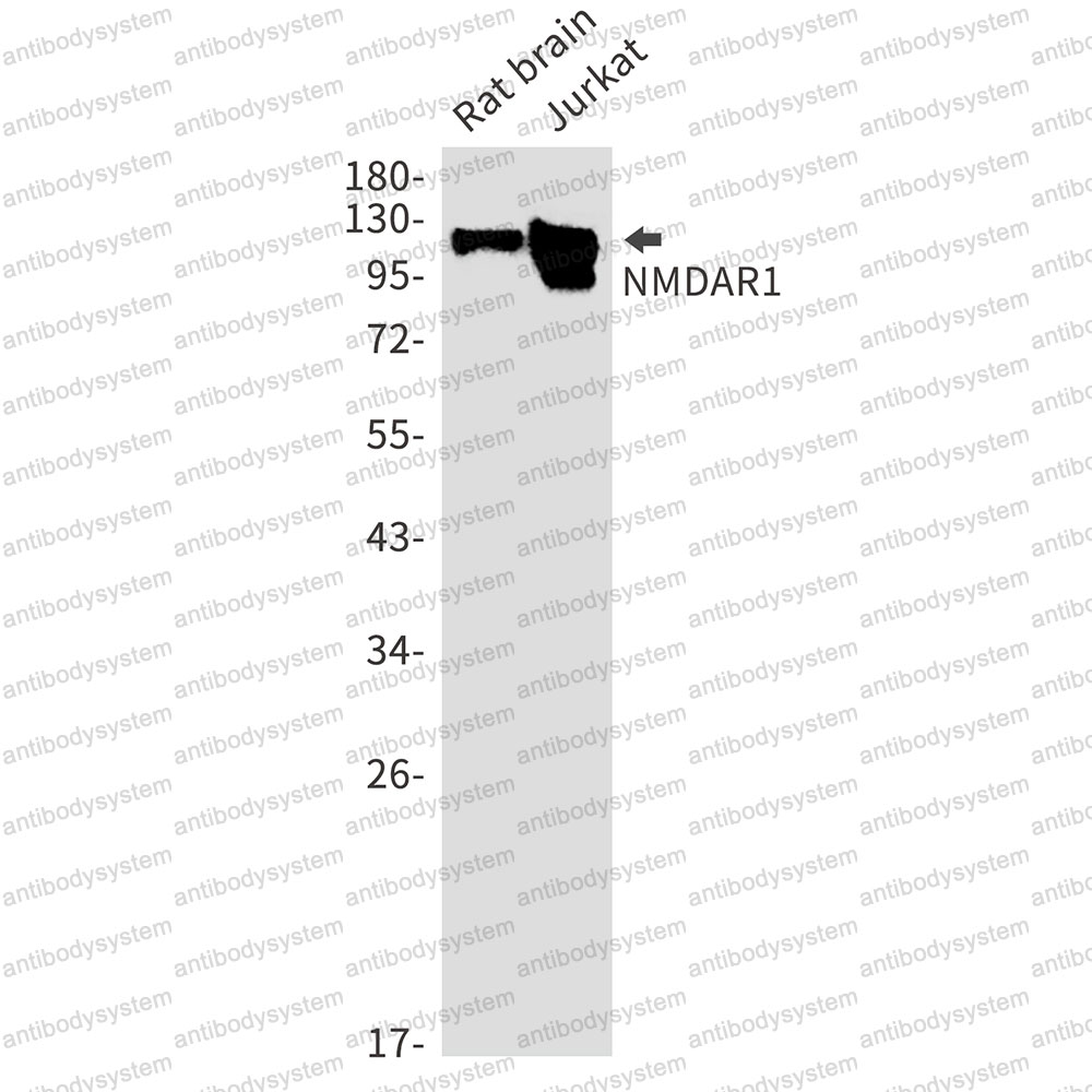 Anti-GRIN1/NMDAR1 Antibody (R2C65)