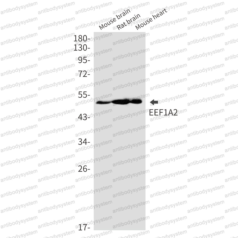 Anti-EEF1A2 Antibody (R2C66)