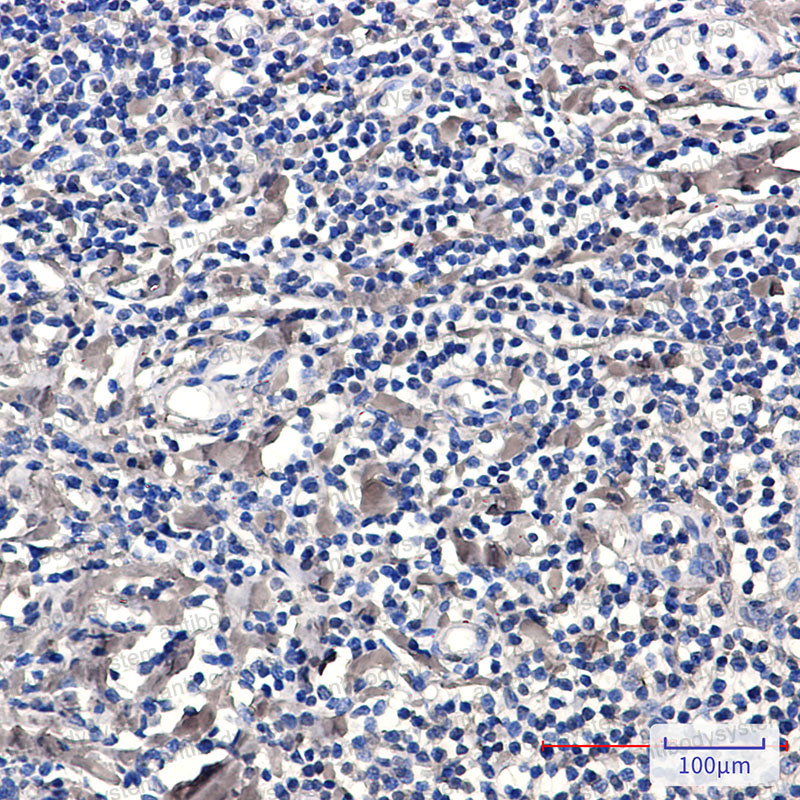 Anti-Phospho-PRKCD/PKC delta (Ser299) Antibody (R2C71)