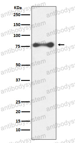 Anti-PRKCD Antibody (R2C67)